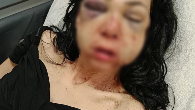 Sema K. kadının yüzüne bardakla saldırdı, tutuklandı
