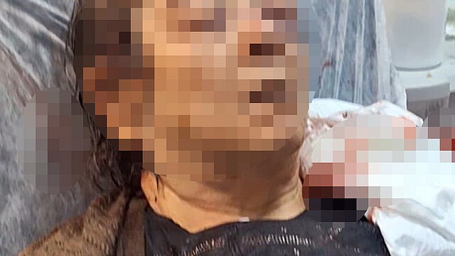 Kayseri'de tavandan kopan moloz altında kadın yaralandı