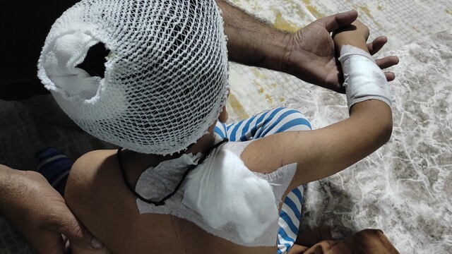 Şanlıurfa'da sahipsiz köpekler 8 yaşındaki çocuğu yaraladı