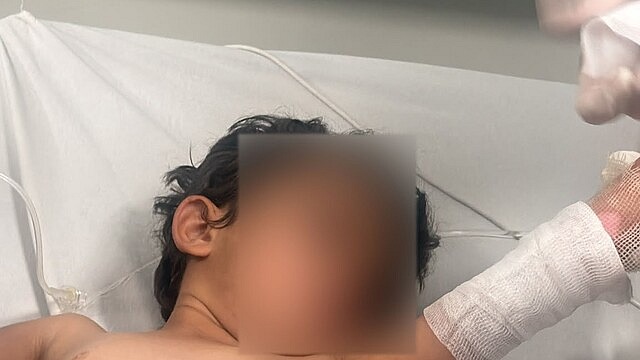 Şırnak'ta 3 yaşındaki çocuğun üzerine kaynar su döküldü